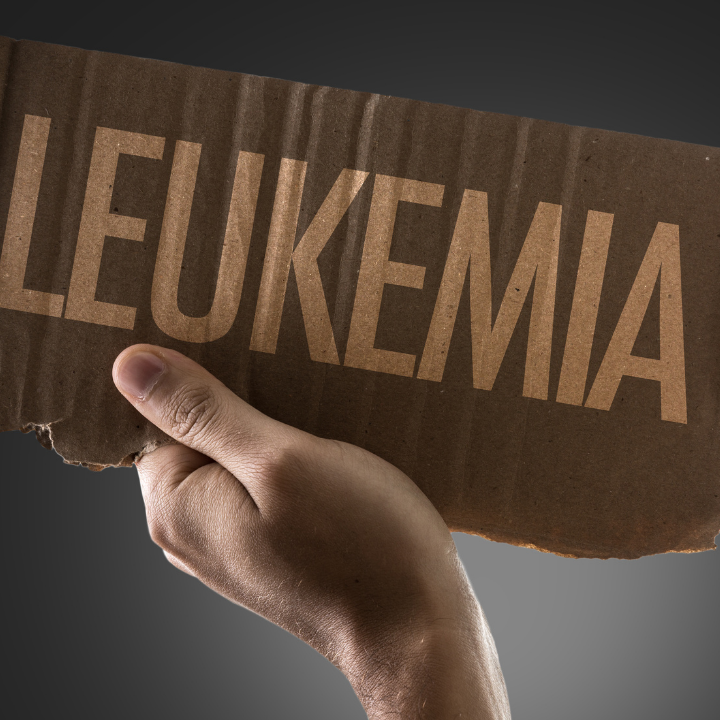 Childhood Leukemia